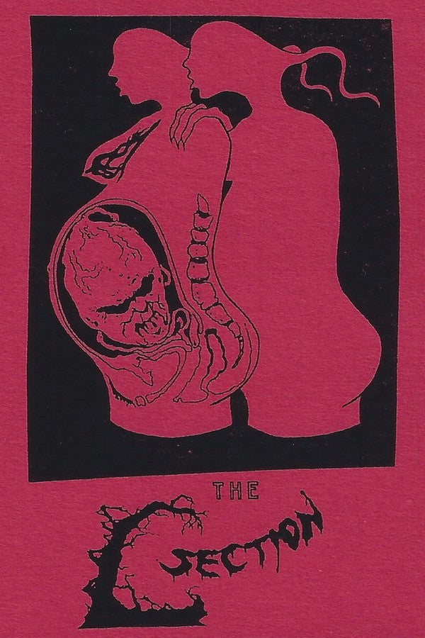 The C-Section: S/T cassette