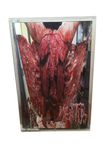 Ulcerated Offal / Meatus: split cassette