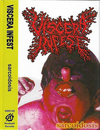 Viscera Infest: Sarcoidosis cassette