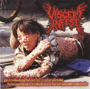 Viscera / Paracoccidioidomicosisproctitissarcomucosis: Gastroduodenalulcerfollicularadenoma Fulminanthepatitishydrocelefacialspasmmyxomatosis / Viscosas Voces Desde La Necroorgia Split CD