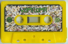 Vomitoma / Pulmonary Fibrosis: Split cassette