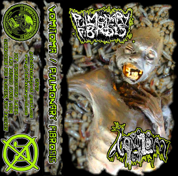 Vomitoma / Pulmonary Fibrosis: Split cassette