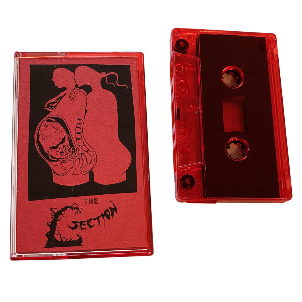The C-Section: S/T cassette