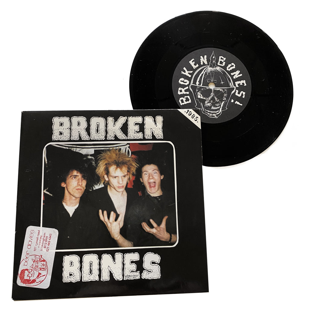 Broken Bones: Seeing Through My Eyes 7